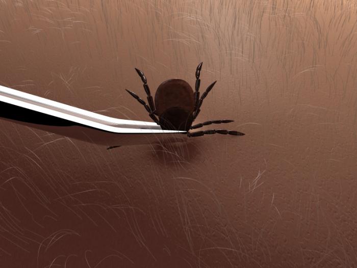 Tick being removed by tweezers.