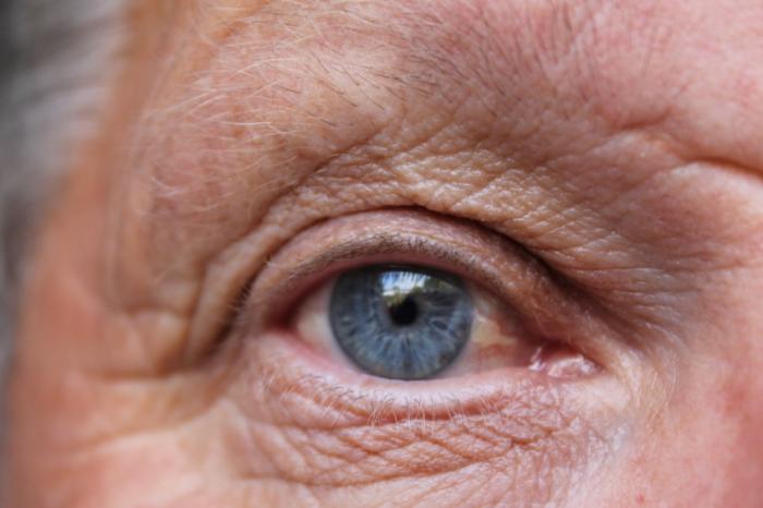 A close-up of an older man's eye