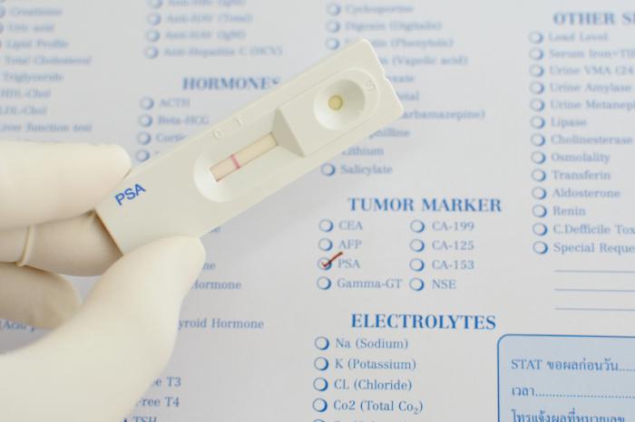 [PSA testing for cancer tumor]