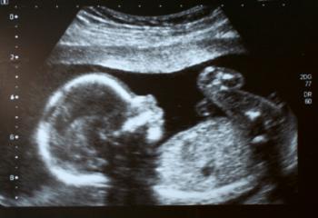 [scan of baby in womb]