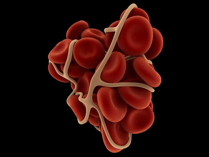 Image of a blood clot.