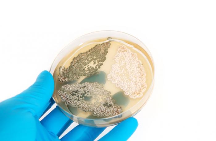 Penicillin growing in a Petri dish.