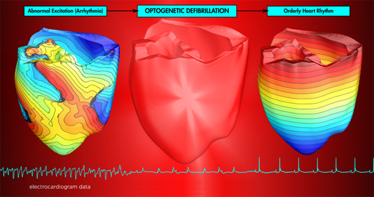 optogenetic-defibrillation