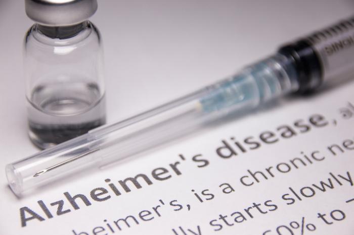 [Alzheimer's disease description and drug]