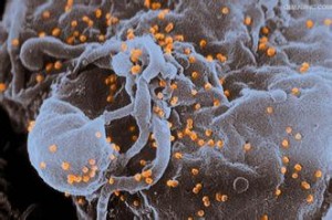 Researchers discover can remove provirus from HIV-1 isolates
