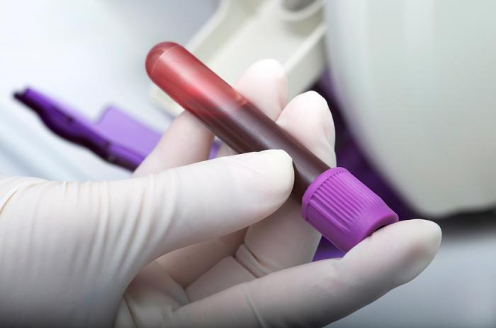 a-test-tube-of-blood