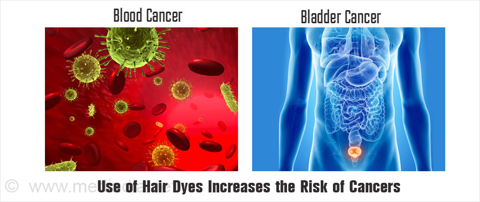Cancer Risks and Hair Dyes