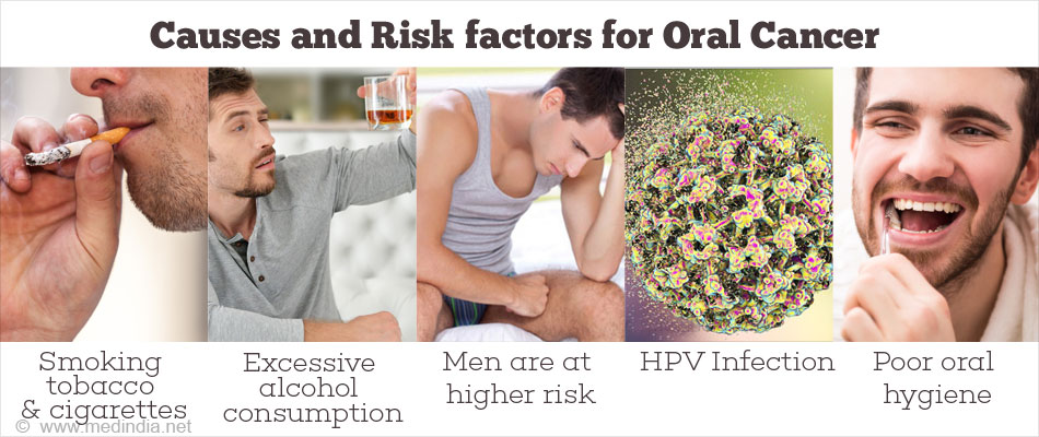 Causes and Risk factors for Oral Cancer