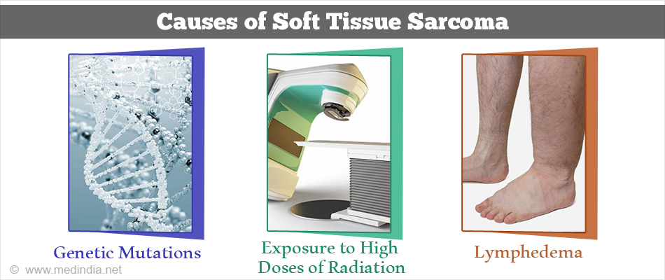 Causes of Soft Tissue Sarcoma