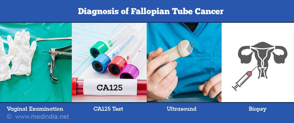 Diagnosis of Fallopian Tube Cancer
