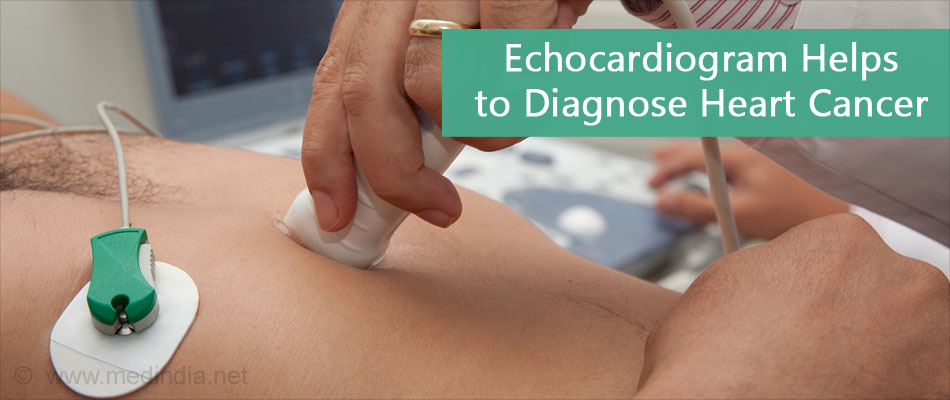 Echocardiogram Helps to Diagnose Heart Cancer