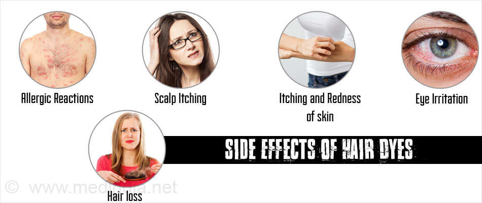 Side Effects of Hair Dyes