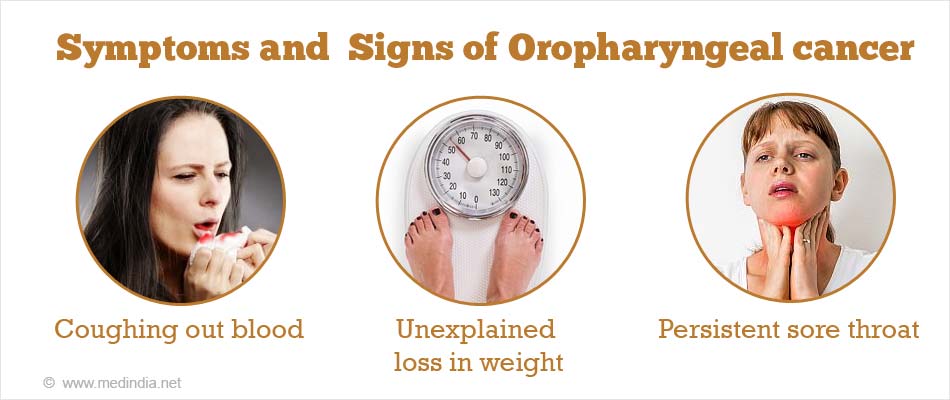 Signs and Symptoms of Oropharyngeal Cancer