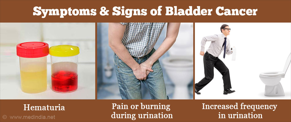 Symptoms & Signs of Bladder Cancer