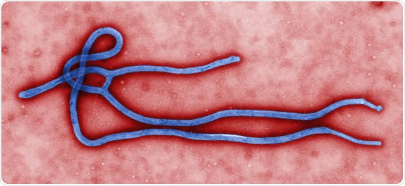 Study: Most Ebola survivors experience brain symptoms more than six months after initial infection