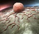 nanoparticles tumor cells