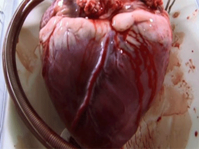 Scientists have Developed the Use of Nuclear Energy in the Hearts