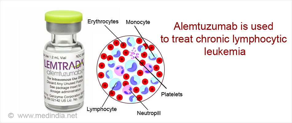 Alemtuzumab Used to Treat Chronic Lymphocytic Leukemia