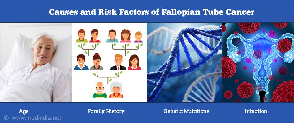 Causes and Risk Factors of Fallopian Tube Cancer