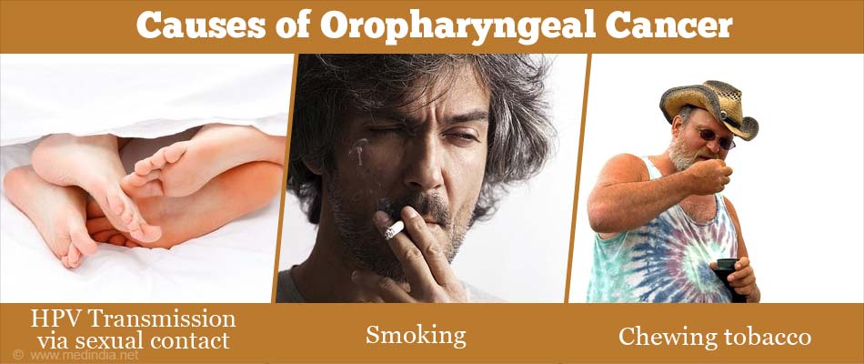 Causes of Oropharyngeal Cancer