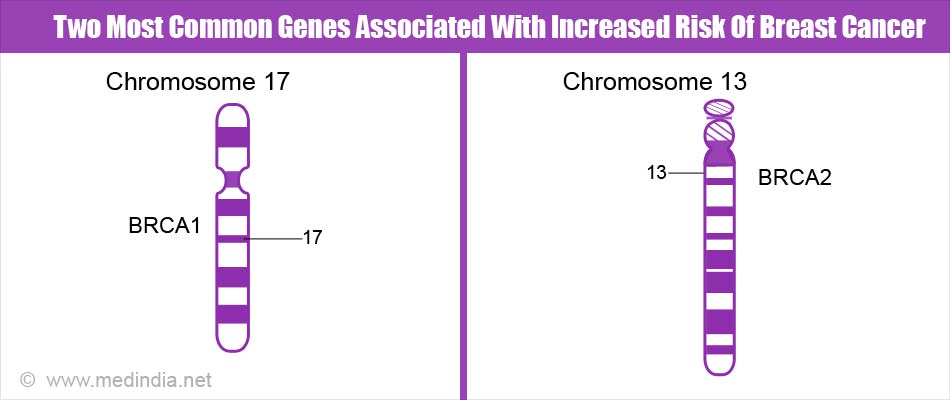 Two Most Common Genes Associated With Increased Risk Of Breast Cancer