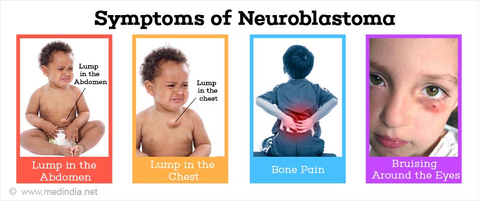 Symptoms of Neuroblastoma
